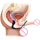 Массажер простаты. Силикон. photo 1